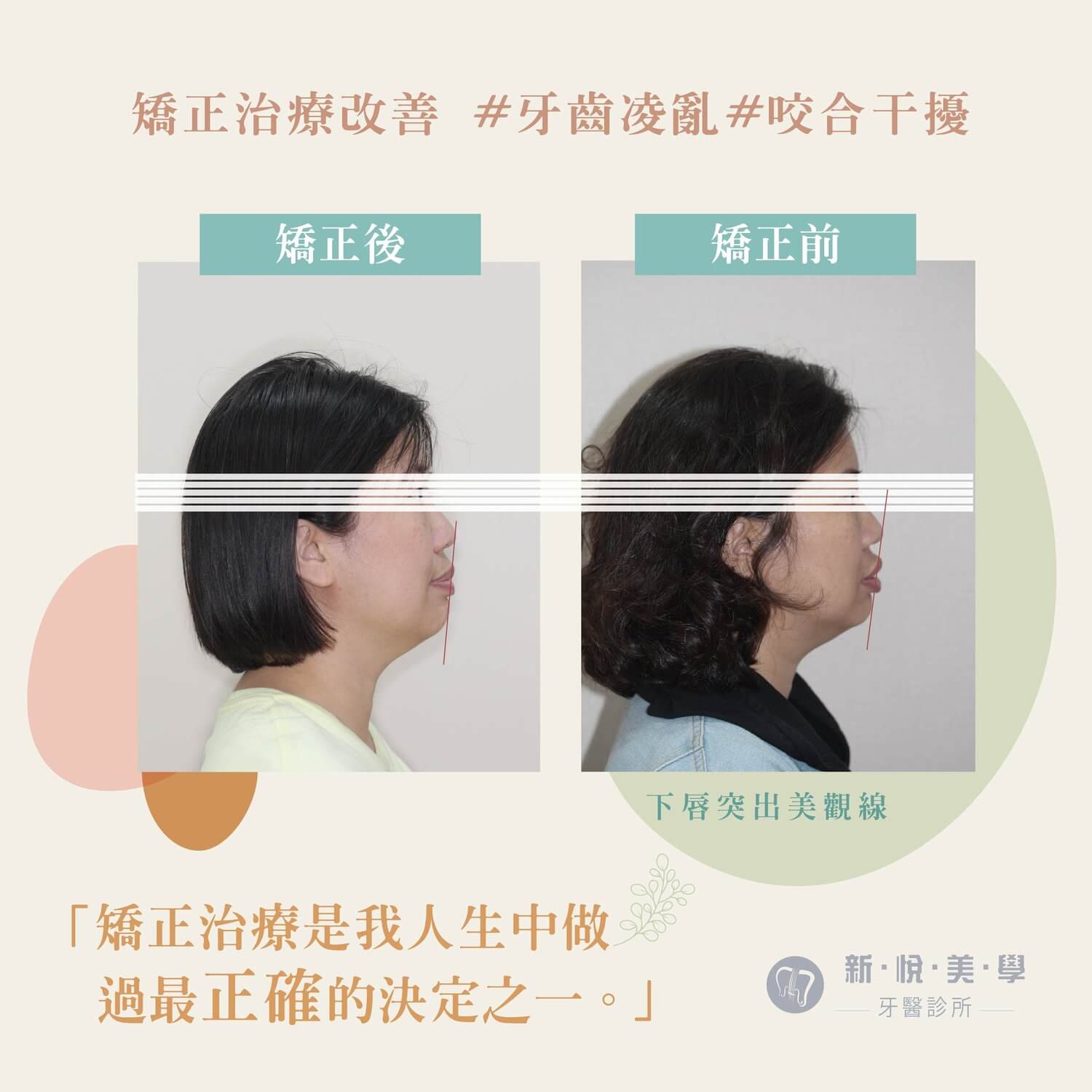 逆齡變身，自信加倍的第2張圖片